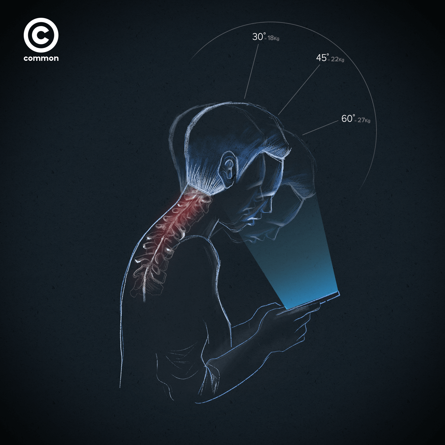 text neck